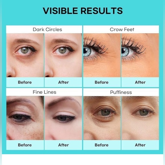 SILKDERMIS Retinol Eye Cream, Eye Cream for Dark Circles and Puffiness - Picture 4 of 4